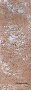 ovar.jpg (42991 Byte)